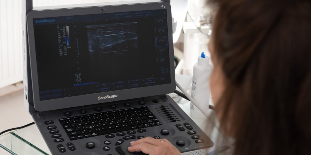 Venenstatus & Dopplerultraschall